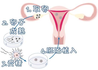 男性因素